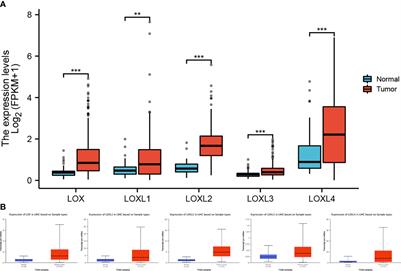 Diagnostic Value, Prognostic Value, and Immune Infiltration of LOX Family Members in Liver Cancer: Bioinformatic Analysis